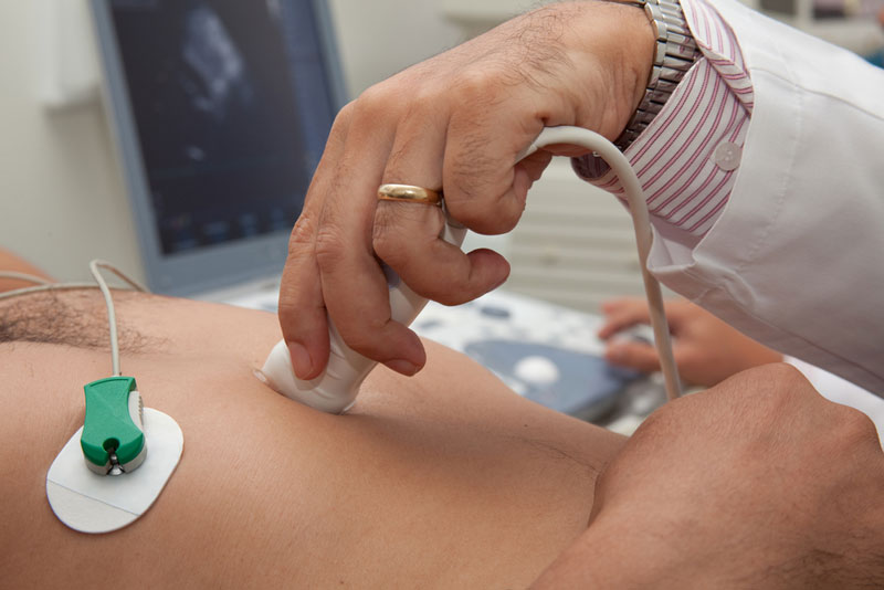 Understanding Atrial Fibrillation: Symptoms, Risks and Treatment